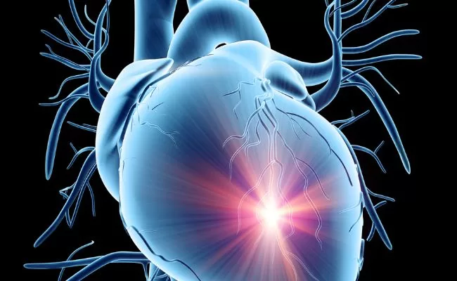 The Risks of SCA: Awareness Tips