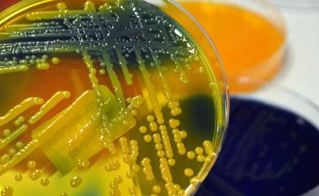 What Is A Biofilm and Why Should Ship Owners Take Care to Prevent It Occurring?